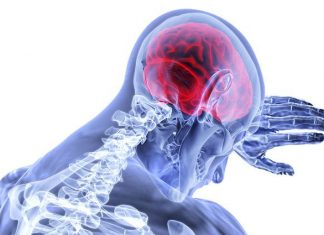 What are the Long-Term Effects of a Stroke?