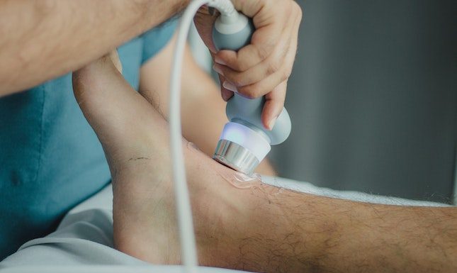 Understanding Varicose Veins: Causes, Symptoms, and Treatment Options