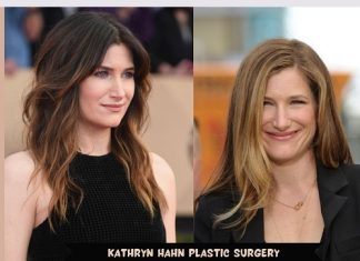 Kathryn Hahn Plastic Surgery: What You Need to Know Kathryn Hahn Plastic Surgery