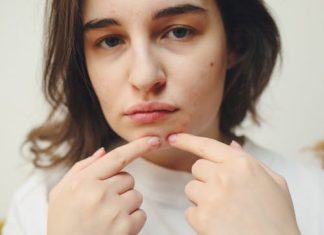 Emerging Trends in Acne Scar Treatments: What to Expect