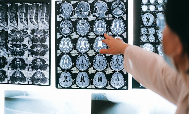 The Signs of a Traumatic Brain Injury That Should Never Be Ignored
