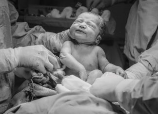 Types of Damages You Can Claim from a Birth Injury Claim