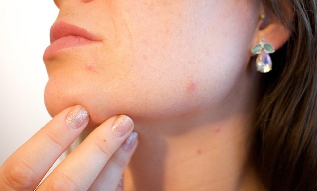 Exploring Non-Invasive Methods for Skin Cancer Detection
