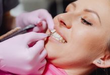 Porcelain Veneers Maintenance: How to Care for Your New Smile