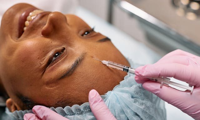 Do Facial Fillers Hurt? 5 Things to Expect During the Procedure