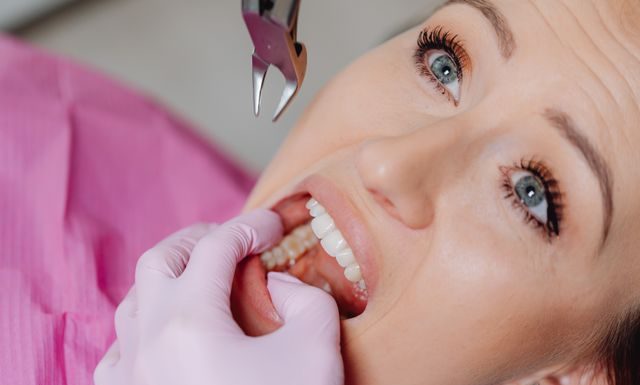 How to Overcome Dental Anxiety and Get the Care You Need